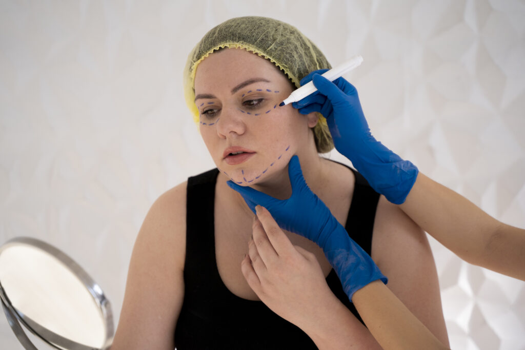 What is a Radiesse BBL and How Does It Work